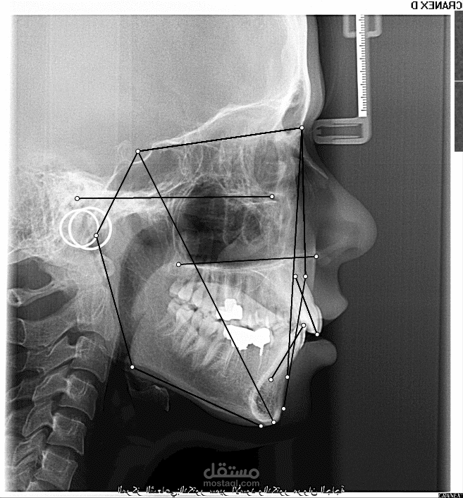 WebCeph - تطبيق ترسيم الصور الشعاعية لأطباء تقويم الأسنان