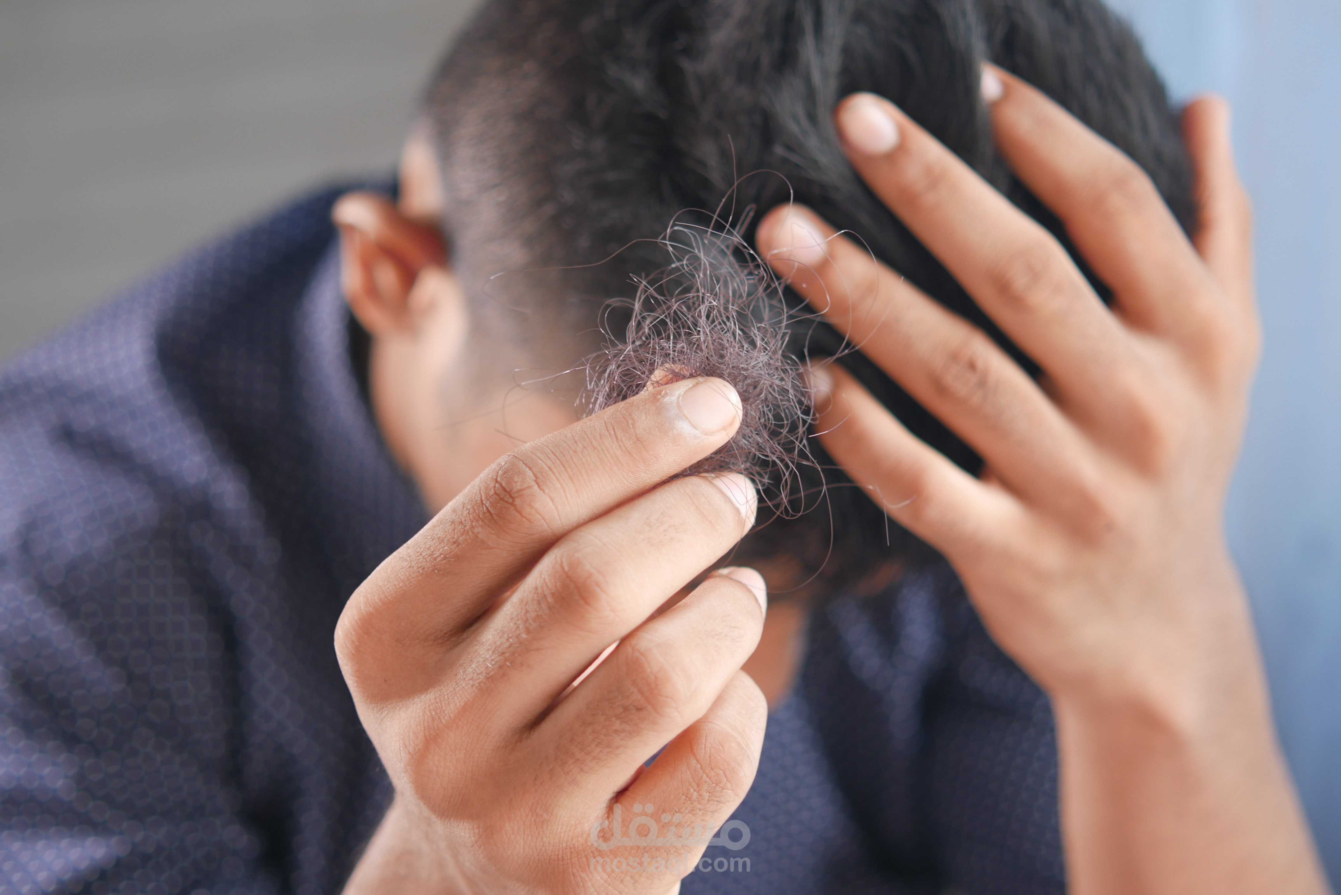 مقالات لعيادة زراعة الشعر