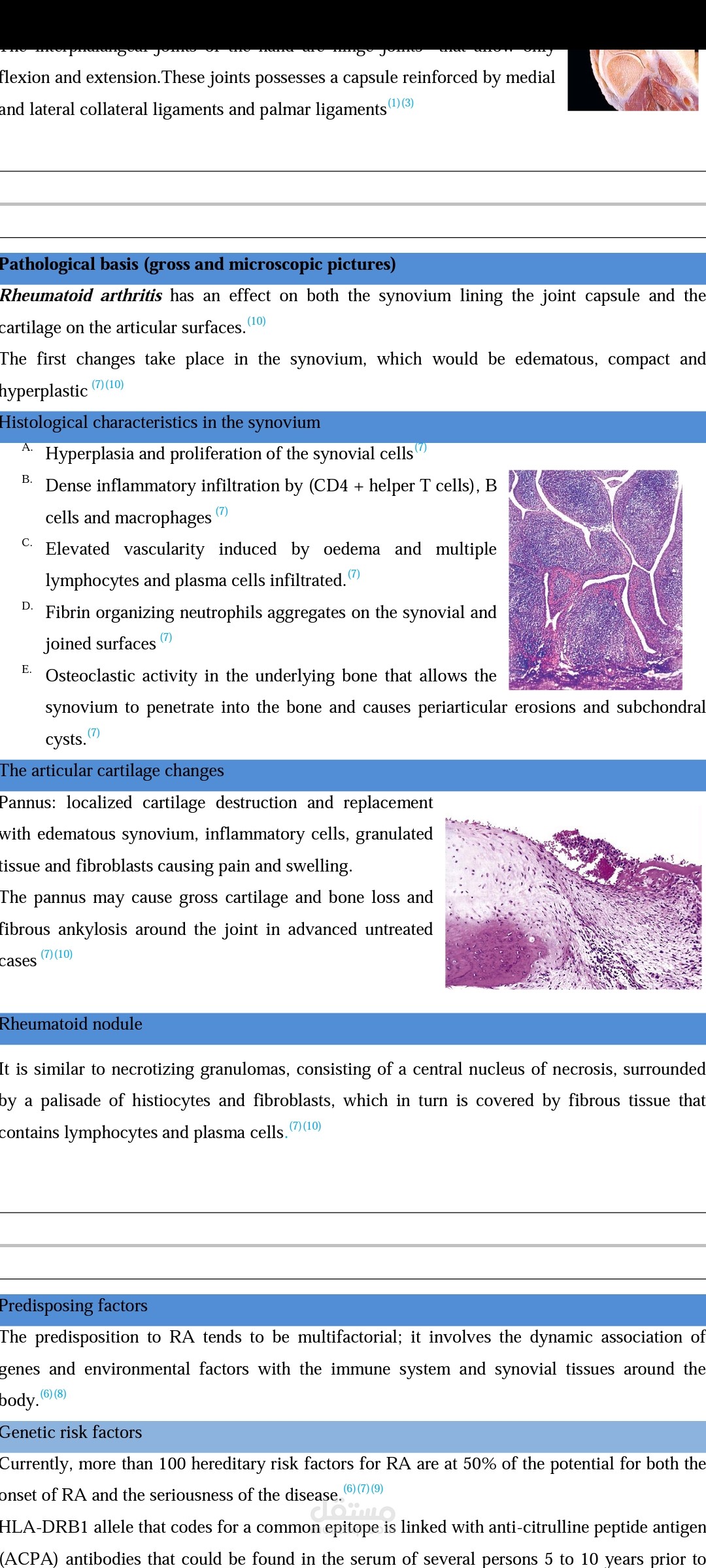 بحث طبي عن rheumatoid arthritis