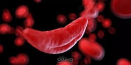 مصاب بفقر الدم المنجلي أو من حولك ؟ما كُتب هنا لك ..