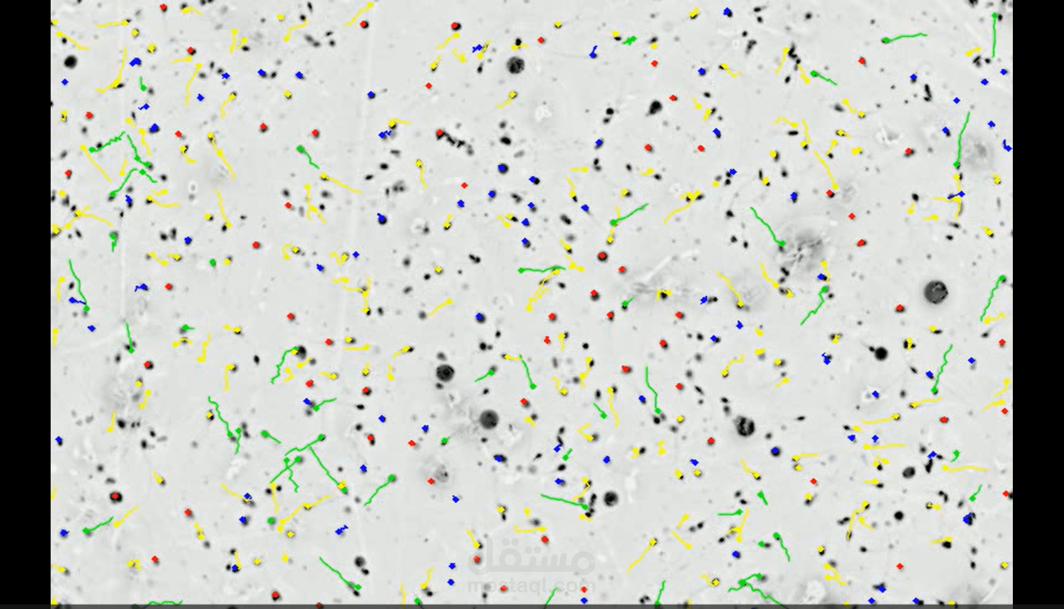 نظام ذكي لتحليل حركة الحيوانات المنوية من فيديوهات المجهر