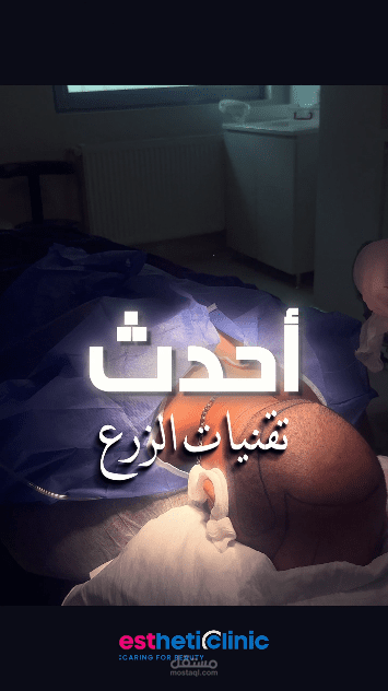 تعليق صوتي لشركة تركية للسياحة العلاجية