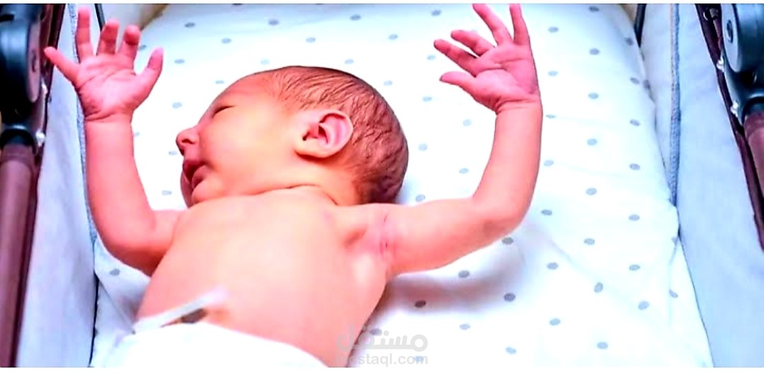 داء الجفلان؛ ما علامات وأعراض داء فرط الإجفالية kok disease