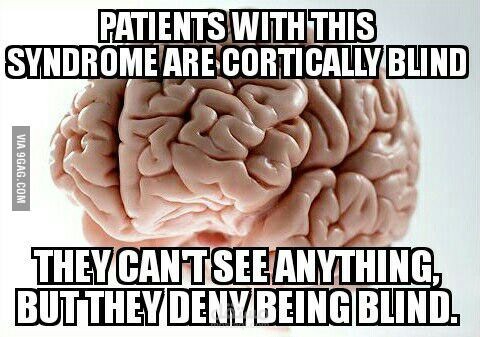 مقالة عن متلازمة "أنتون"/Anton's syndrome