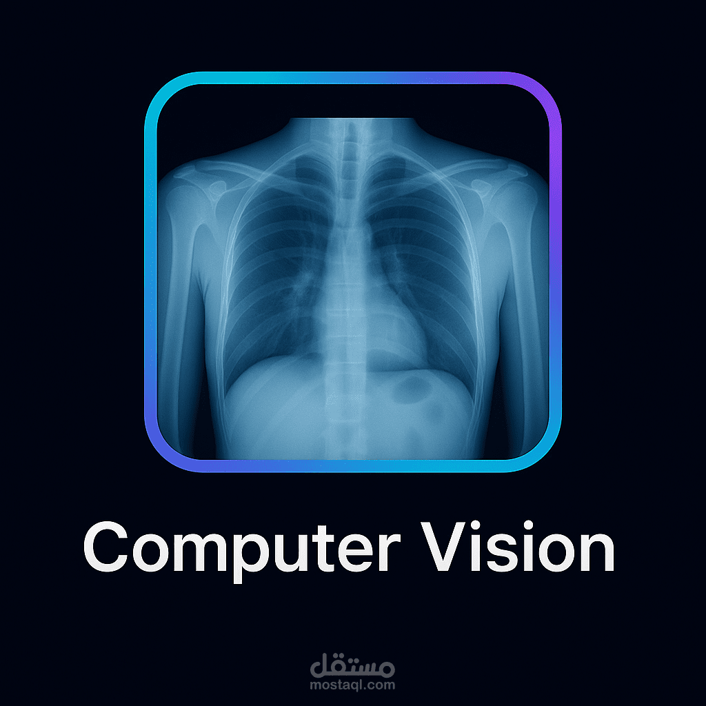 Computer Vision Project ( Lung X-ray Classification )