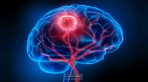 Brain-Tumor-Detection