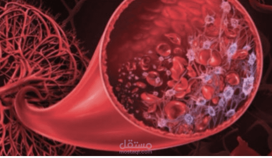 بحث علمي اجنبي عن مرض دموي وكلوي نادر.