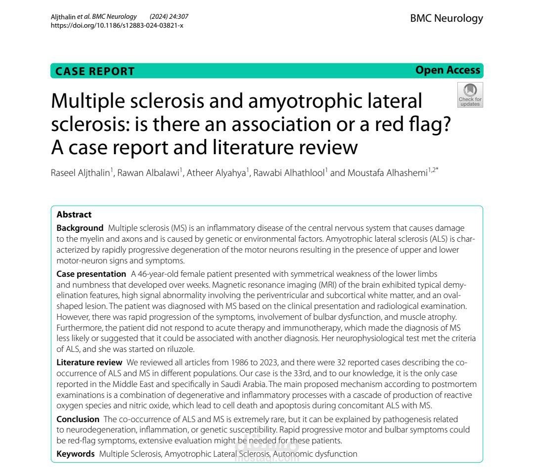 Research study - BMC Neurology - Literature Review and Case Report - Multiple sclerosis and amyotrophic lateral sclerosis: is there an association or a red flag? A case report and literature review