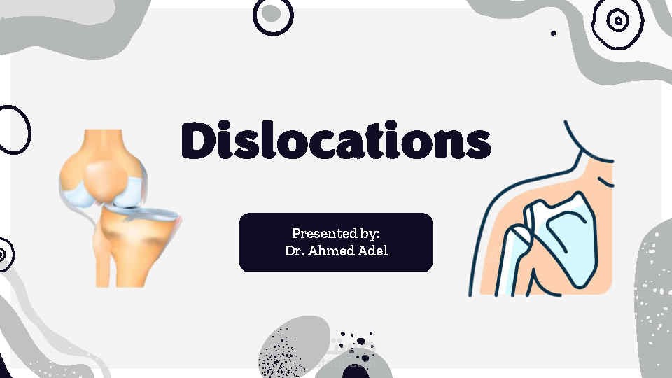 Dislocations PowerPoint