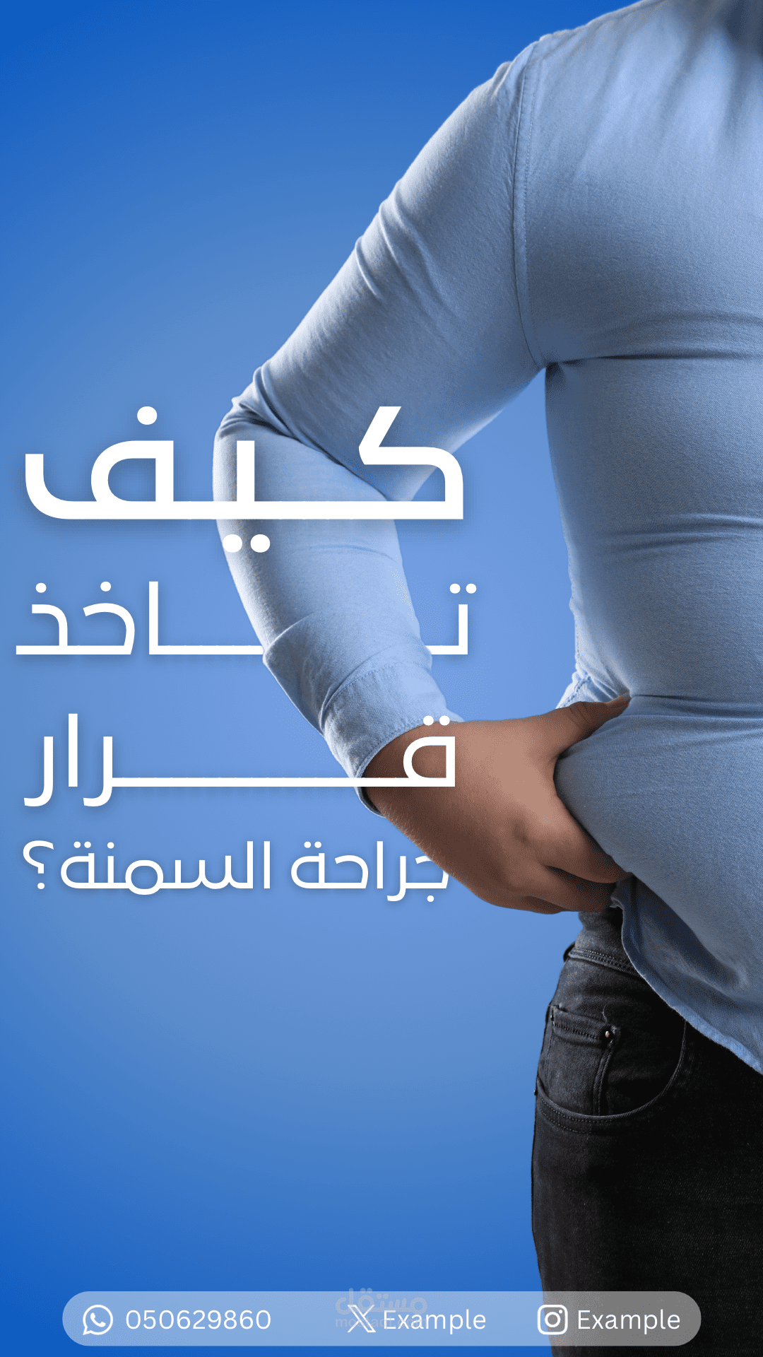 تصميم ستوري لجراحة السمنة