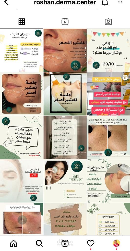 تسويق عبر الانسغرام لمركز بشرة