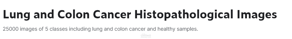 Breast Cancer