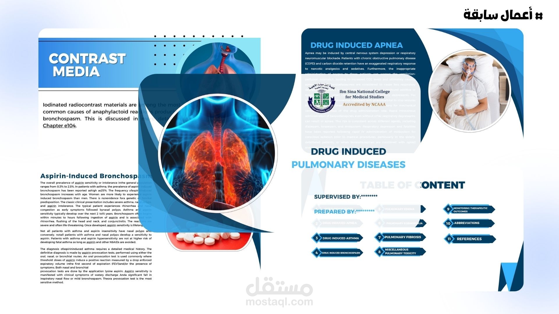 تلخيص (DRUG INDUCED PULMONARY DISEASES )