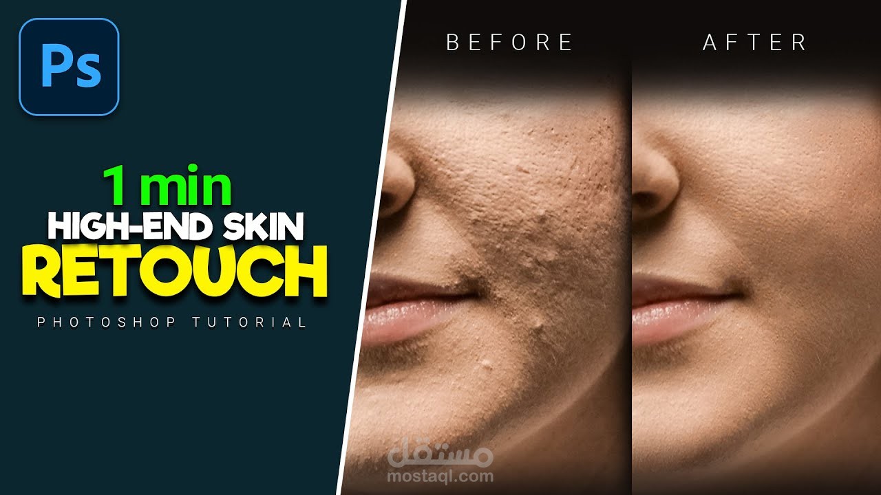 A Quick and Easy Way to Repair Skin in Photoshop