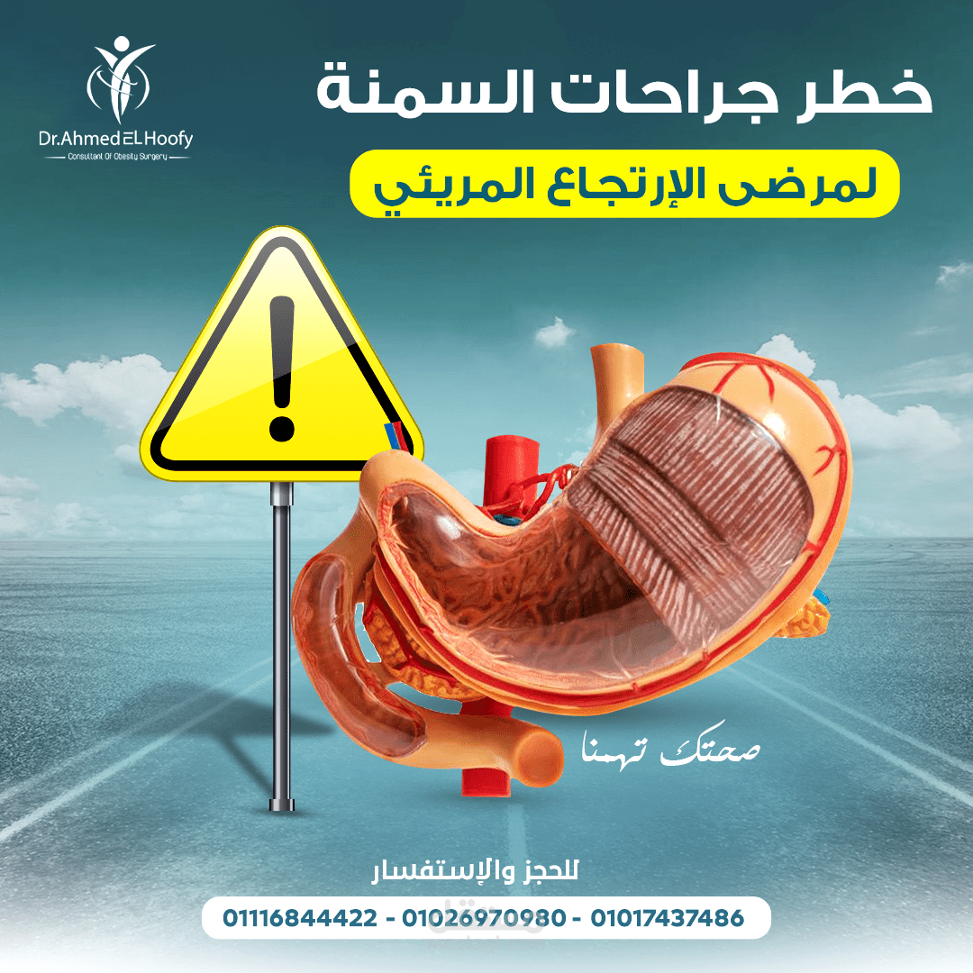 دكتور جراحة سمنة