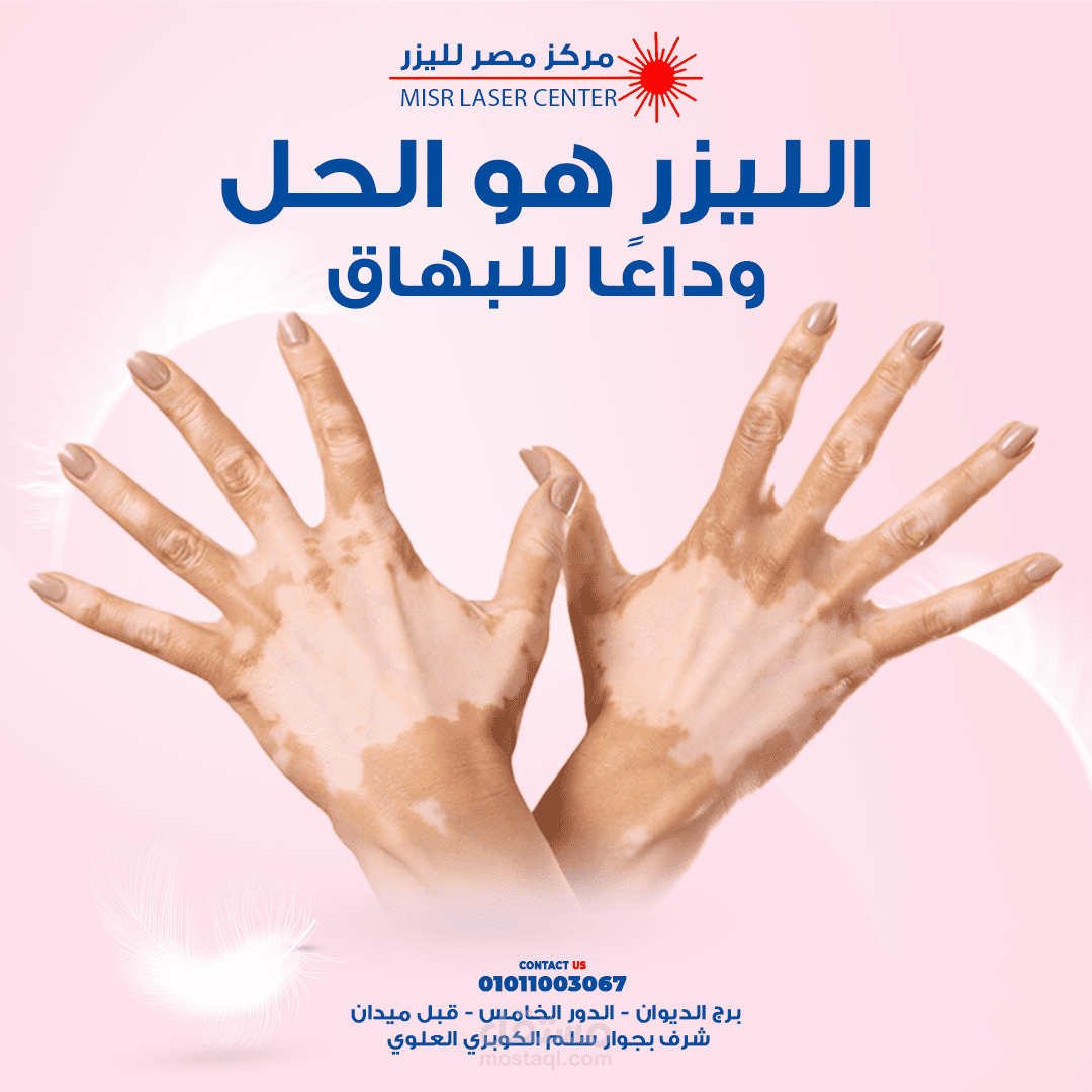 مصر لليزر