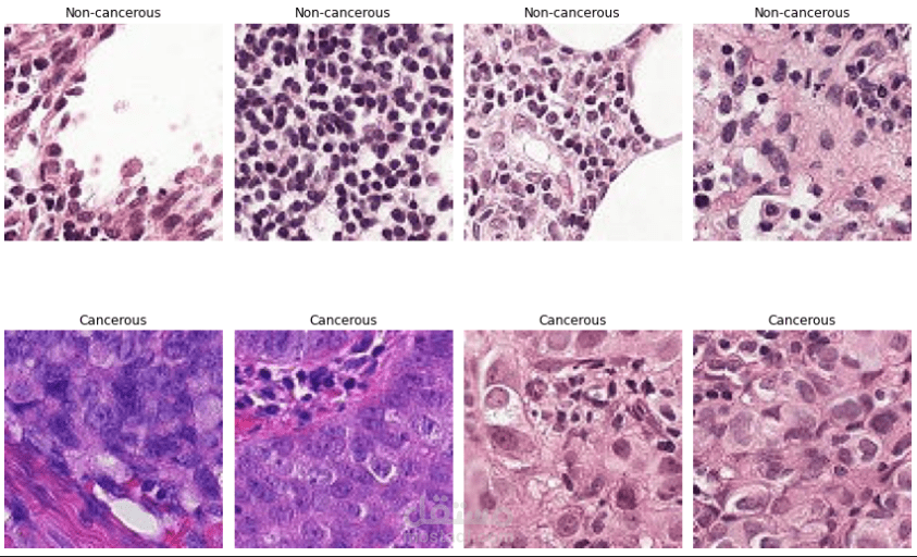 نظام التعلم الآلي للتعرف على صور سرطان الأنسجة وتصنيفها
