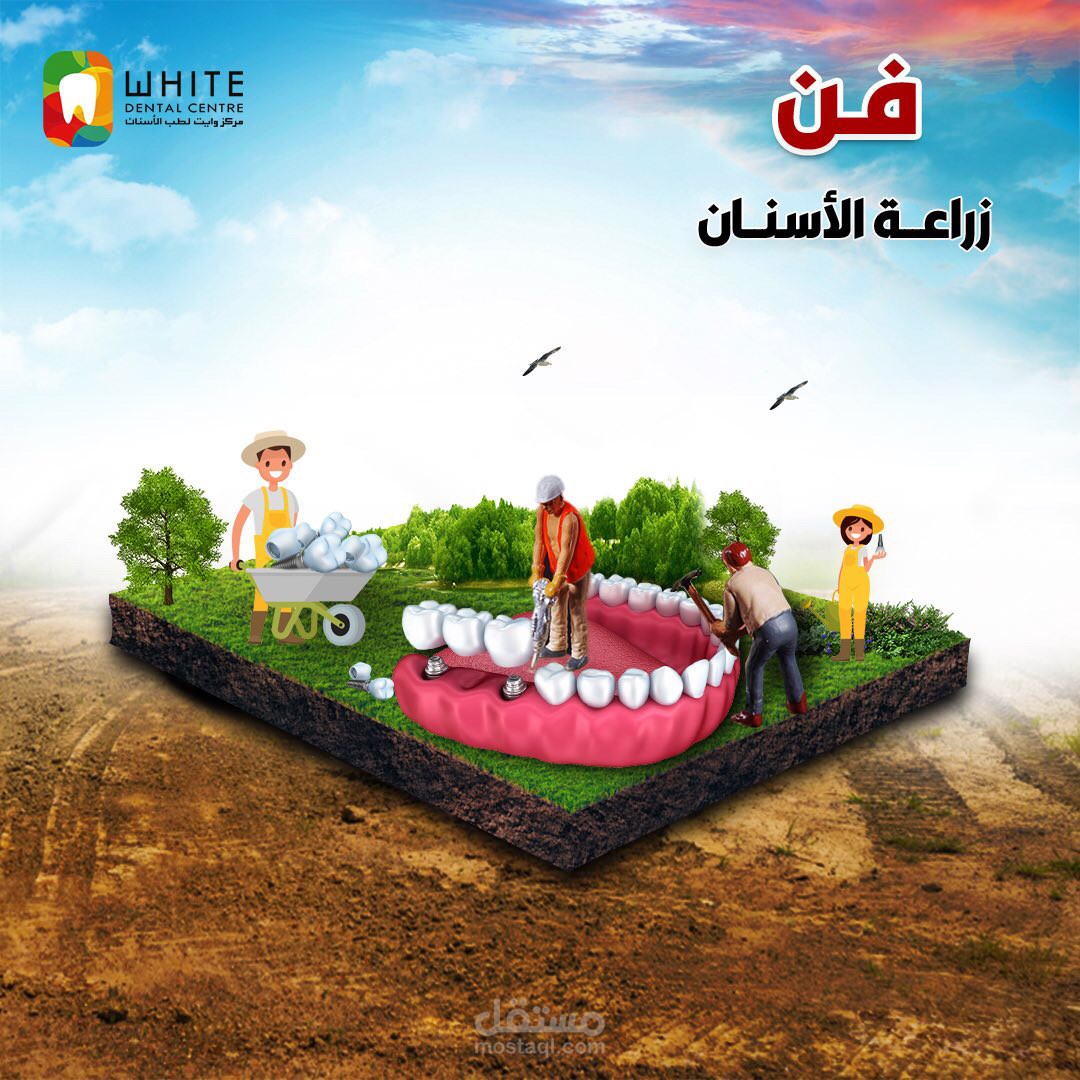 بوستر دعائي عن زراعة الاسنان