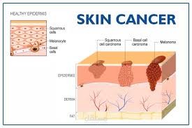 Skin Cancer App (Episcan)