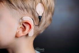 Cochlear implant