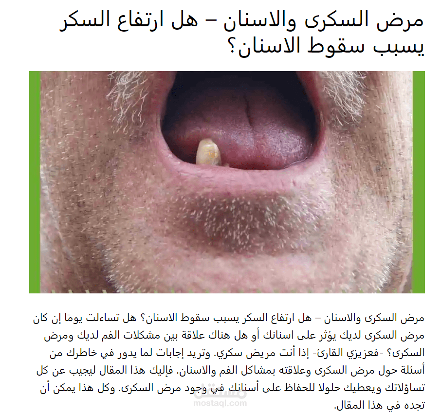 مقال منشور على موقع أسناني باللغة العربية عن مرض السكرى وعلاقته بالأسنان