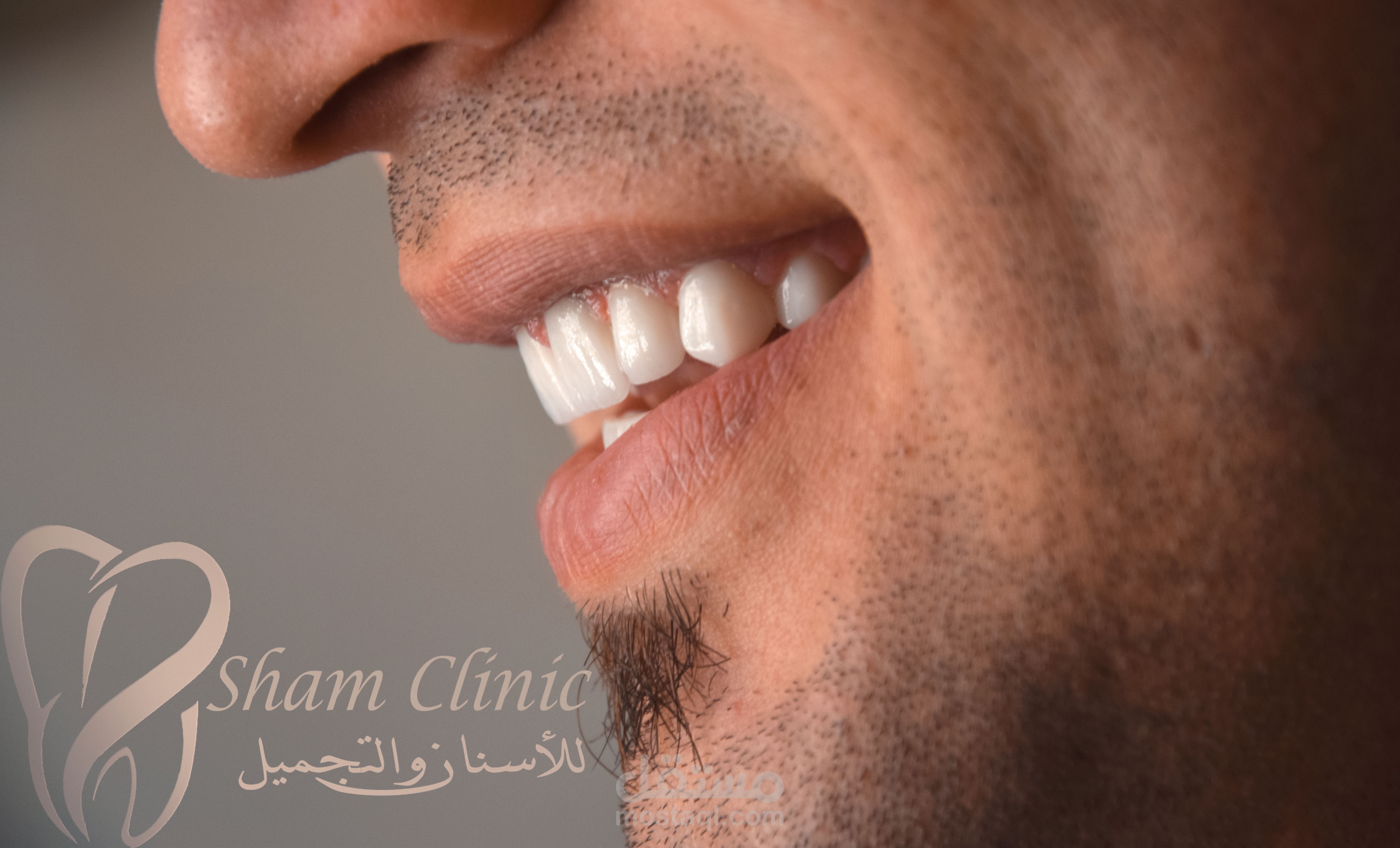 تصوير