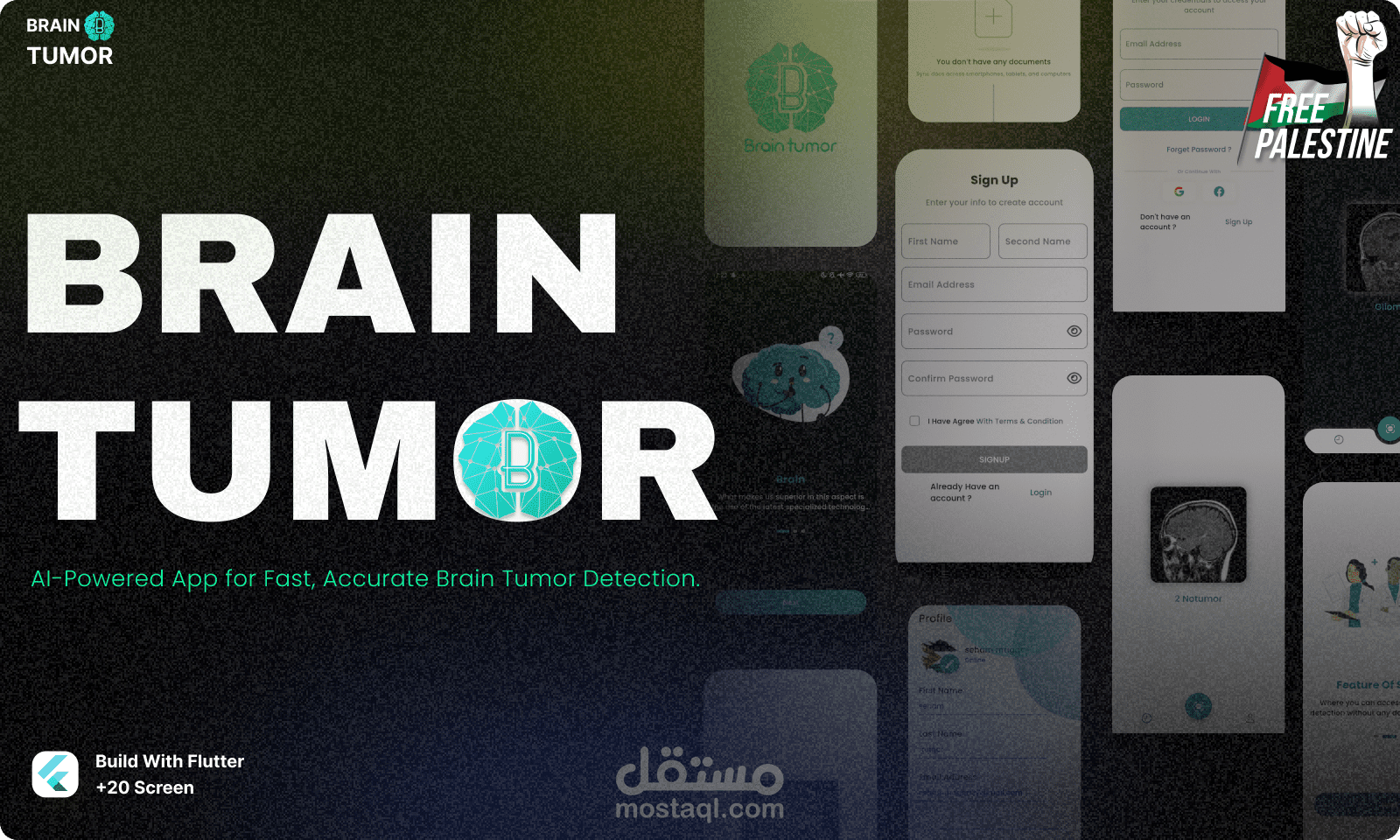 Brain tumor