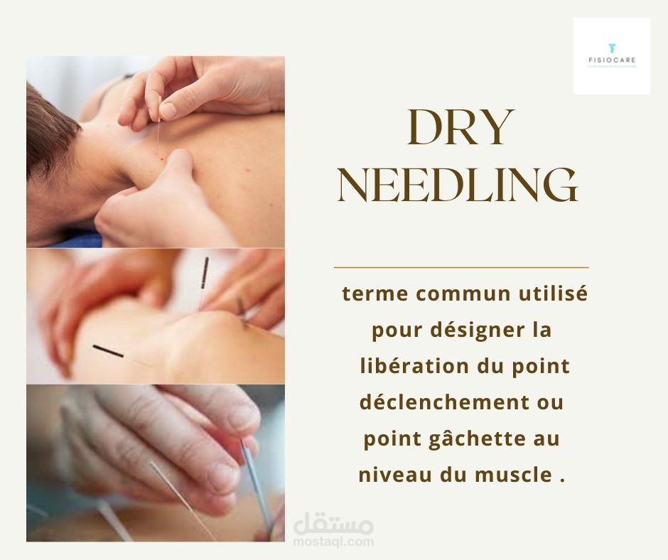 تصميم حول تقنية مستخدمة في العلاج الطبيعي