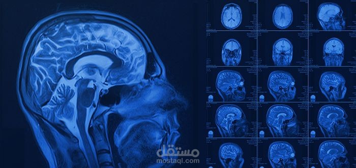 نموذج ذكاء اصطناعي لتقسيم صور الرنين المغناطيسي وتحديد أورام الدماغ (Brain Tumor MRI Segmentation)