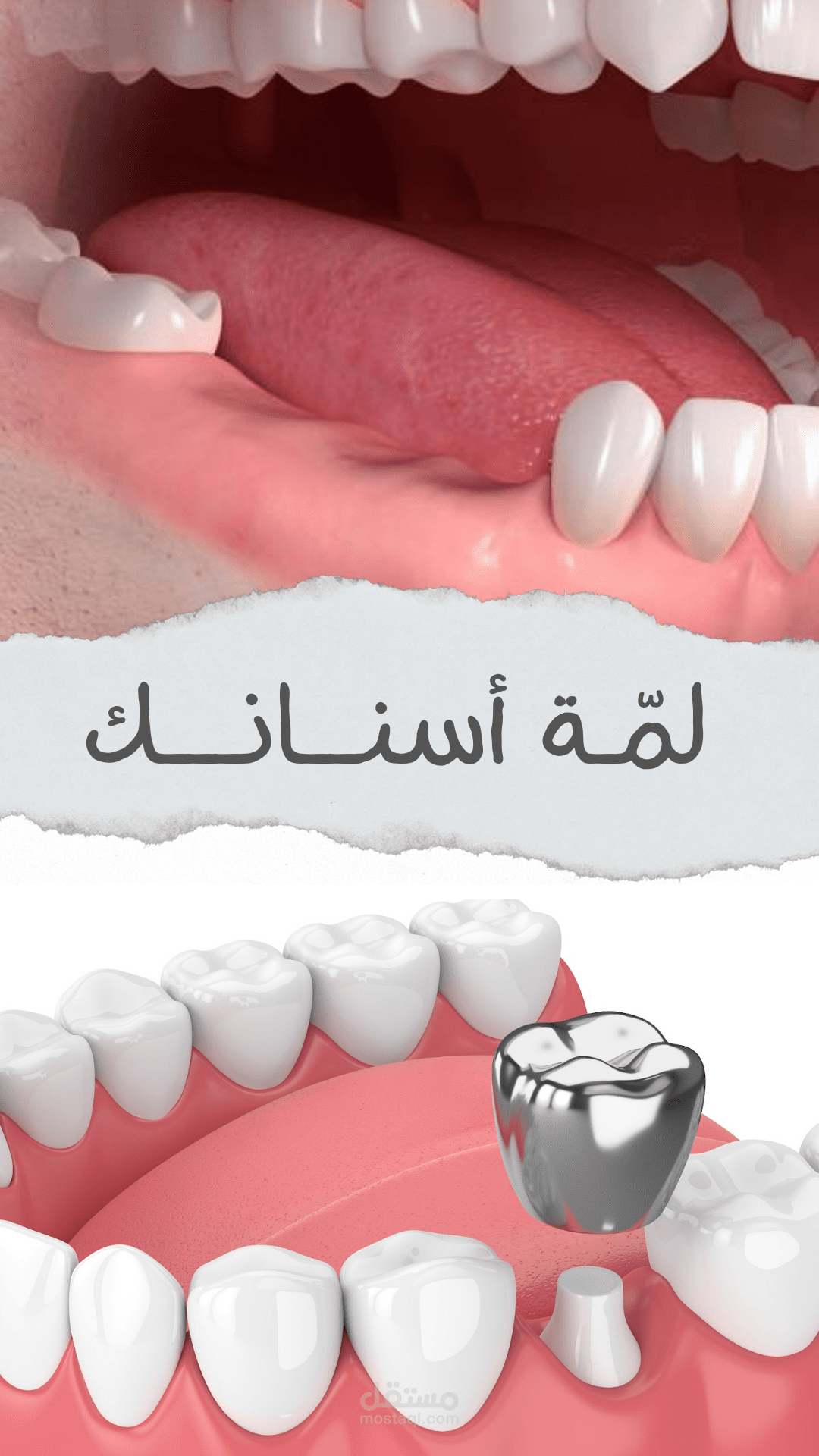 ستوري عيادة أسنان