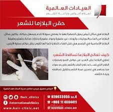 في التصميم اعلانات وسيكون مشروع عالي الدقه