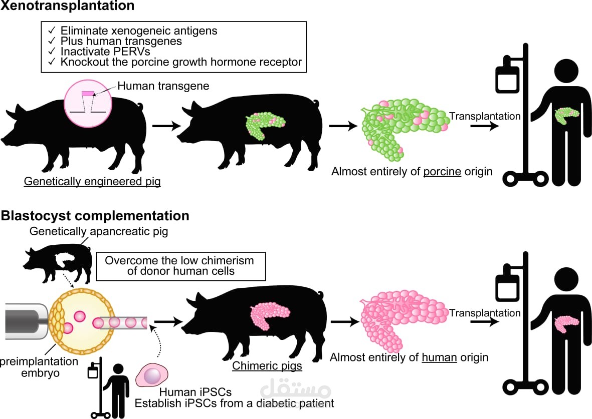 Transplanting organs into the human body
