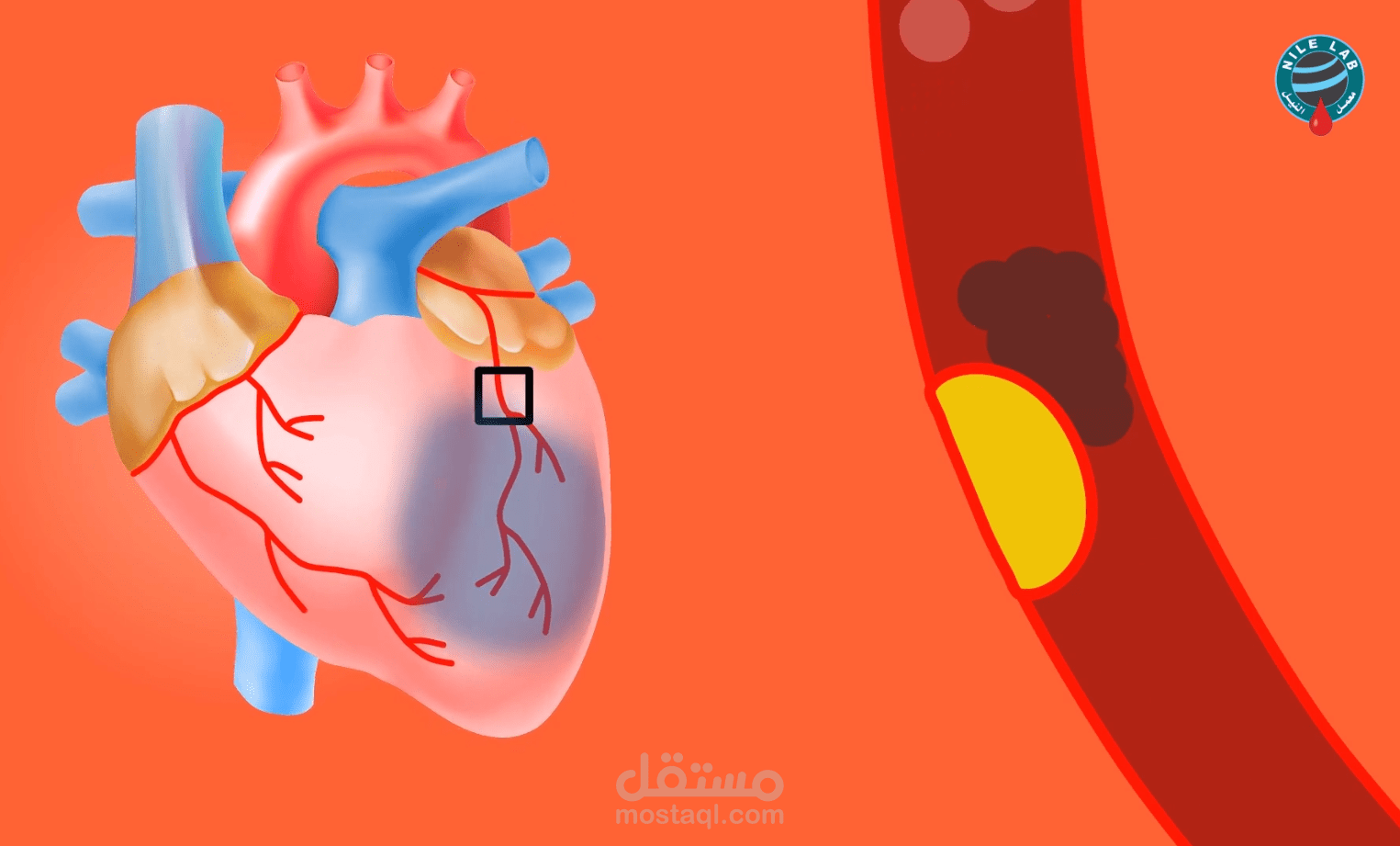 Nile lab - معمل النيل | Cholesterol - الكولسترول