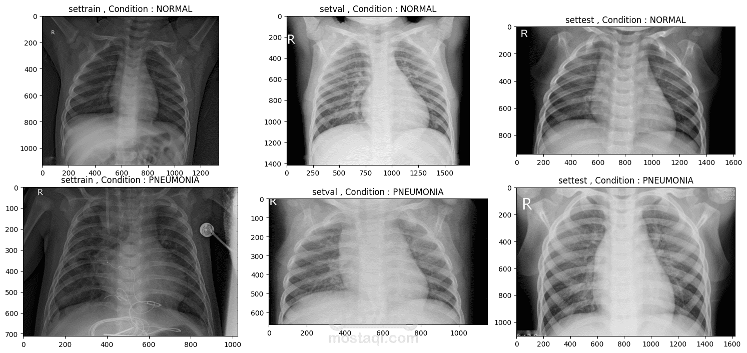 موديل ذكاء اصطناعي لتشخيص مرض ال Pneumonia من خلال ألأشعه X ray