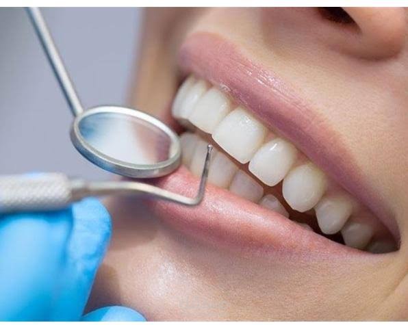 أفكار لمحتوى مركز أسنان علاجي وتجميلي ب سينا