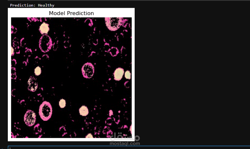 Microscopic Blood Cell Classification using Deep Learning