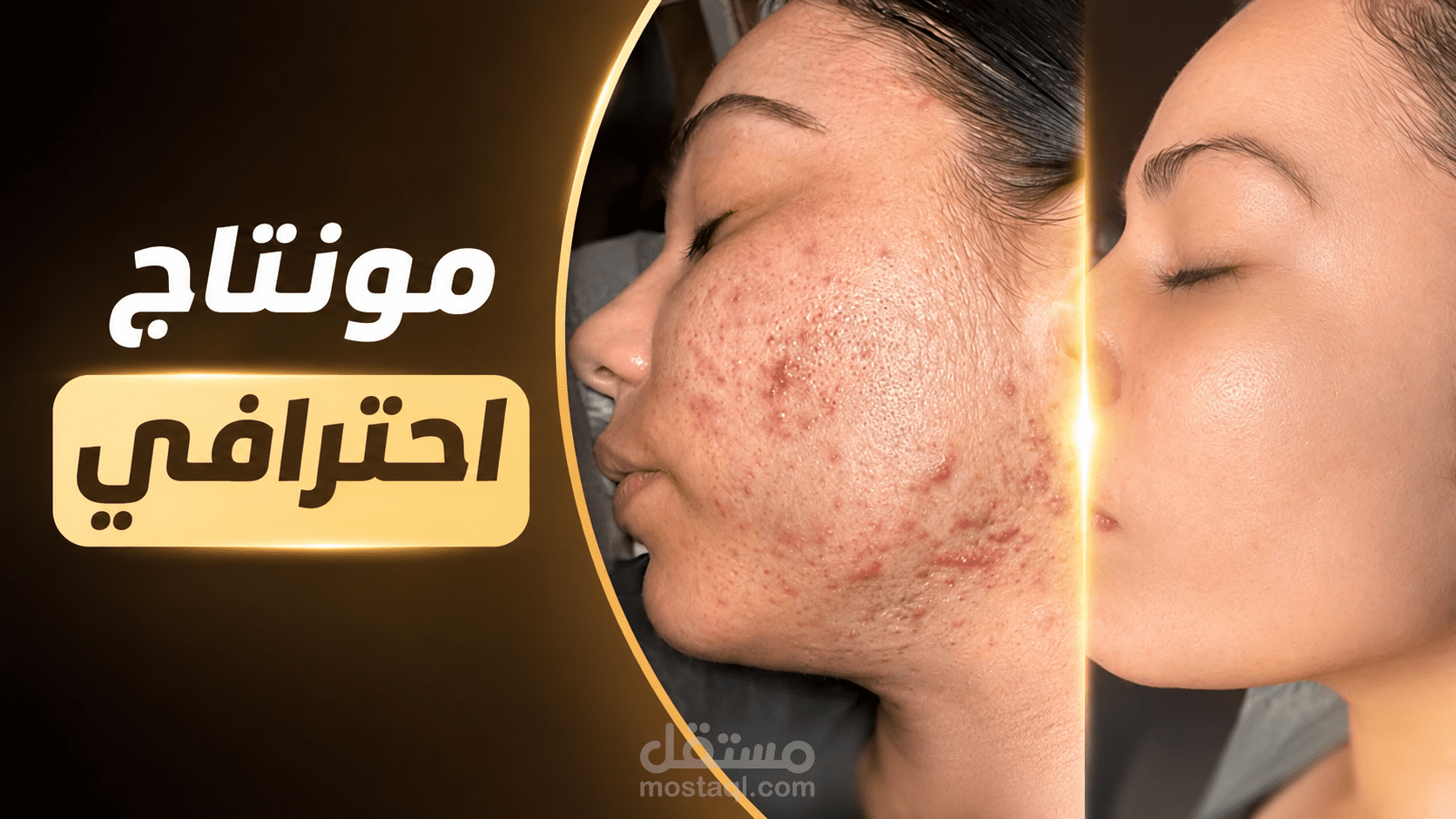مونتاج إعلان ريلز | براند طبي