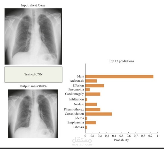 Chest X-ray Classification | مستقل