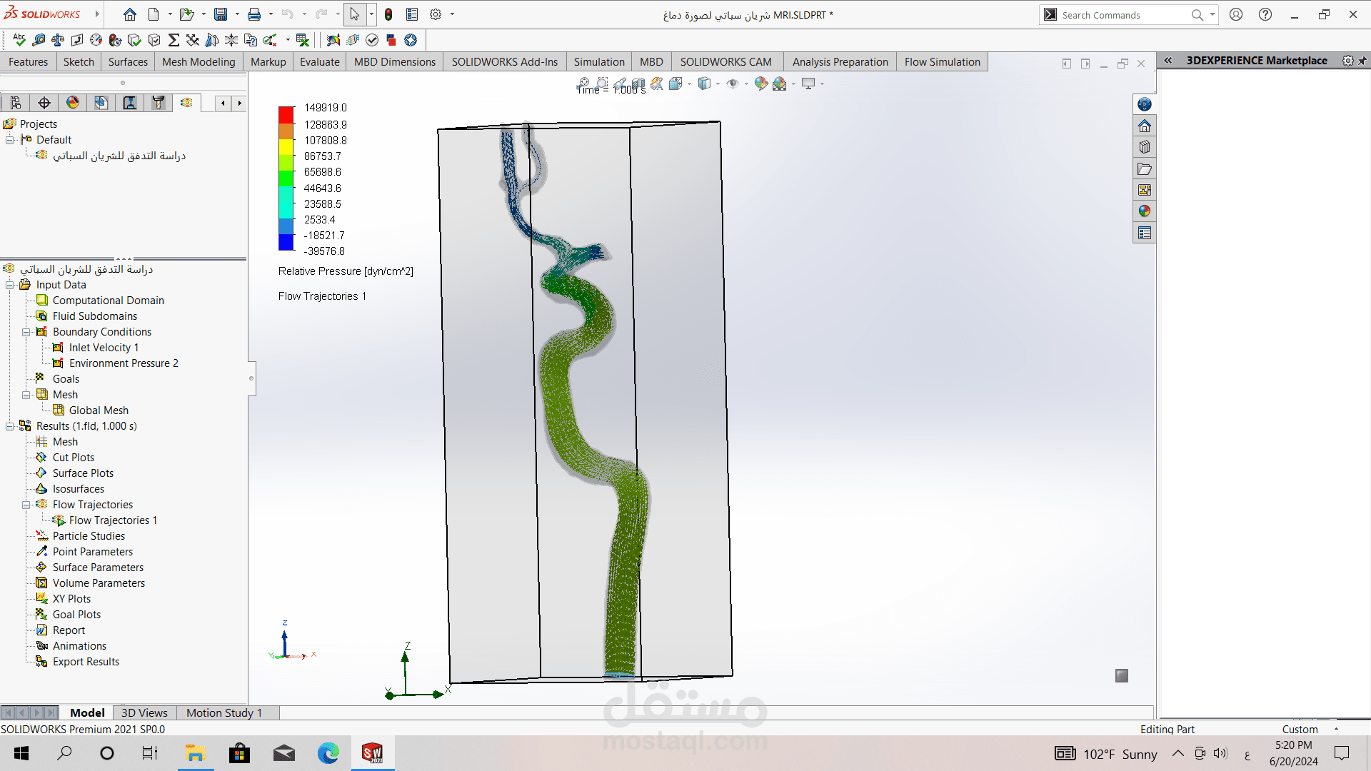 Predictive Study of Stroke Cases Based on Computer Analysis of the Carotid Artery