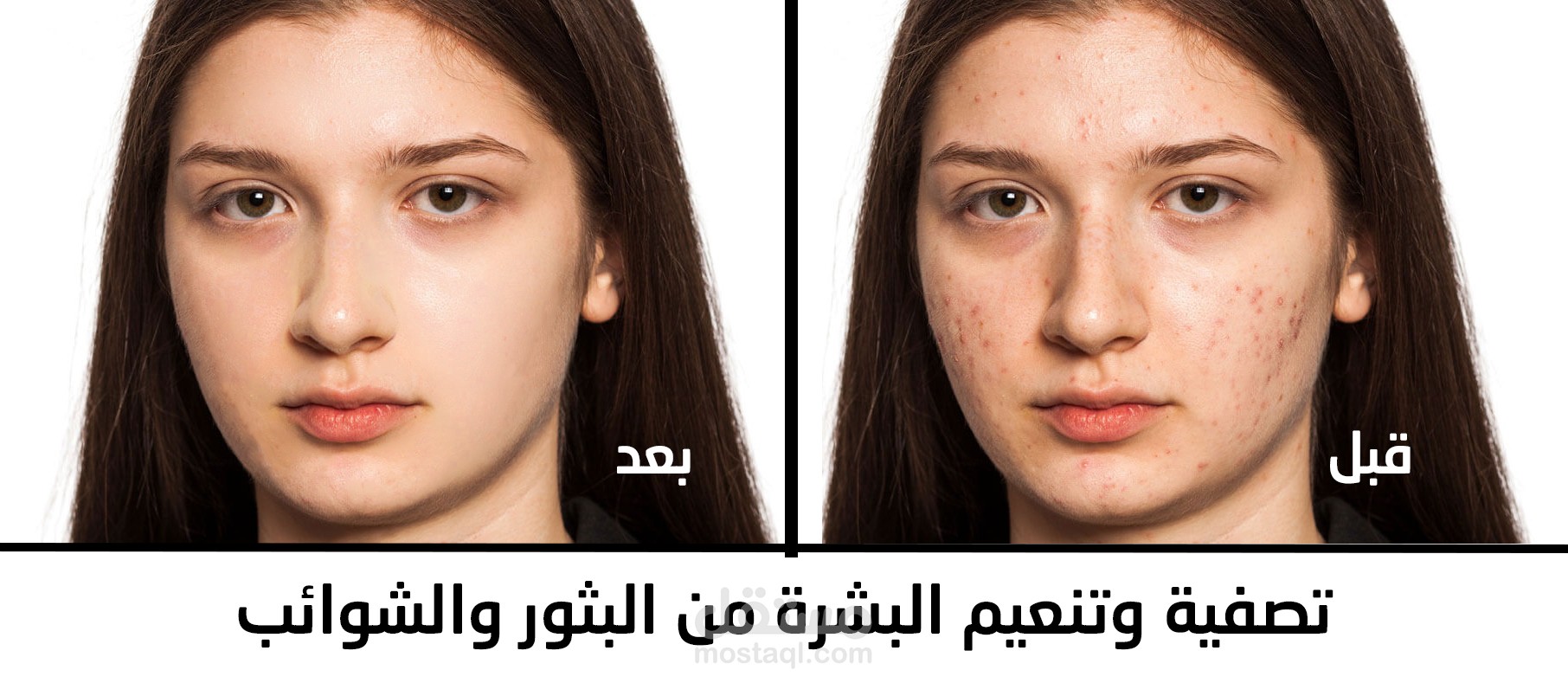 تعديل الصور - تصفية وتنعيم البشرة من البثور والشوائب