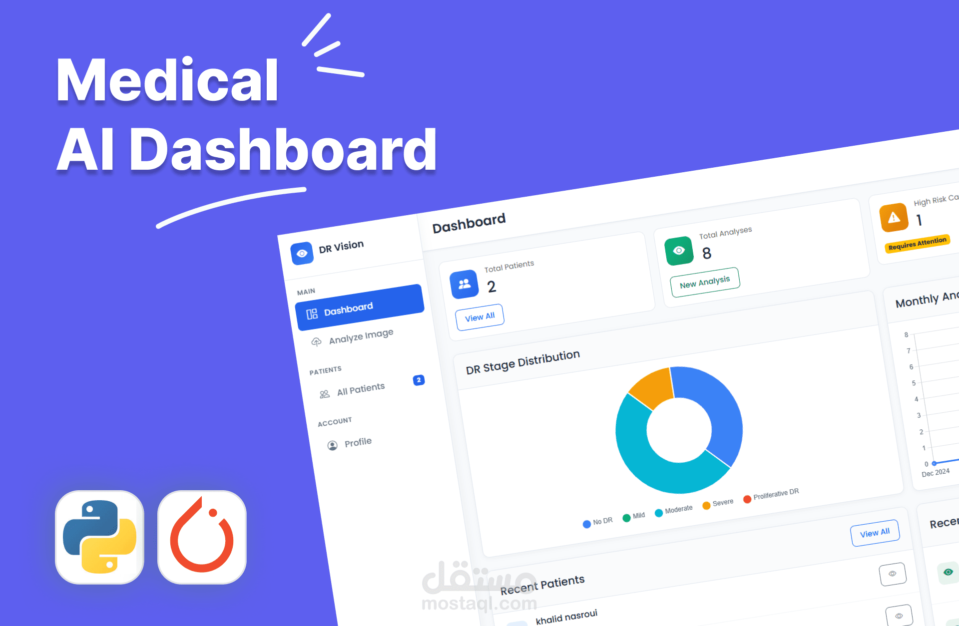 نظام ذكاء اصطناعي للتشخيص الطبي من صور العين