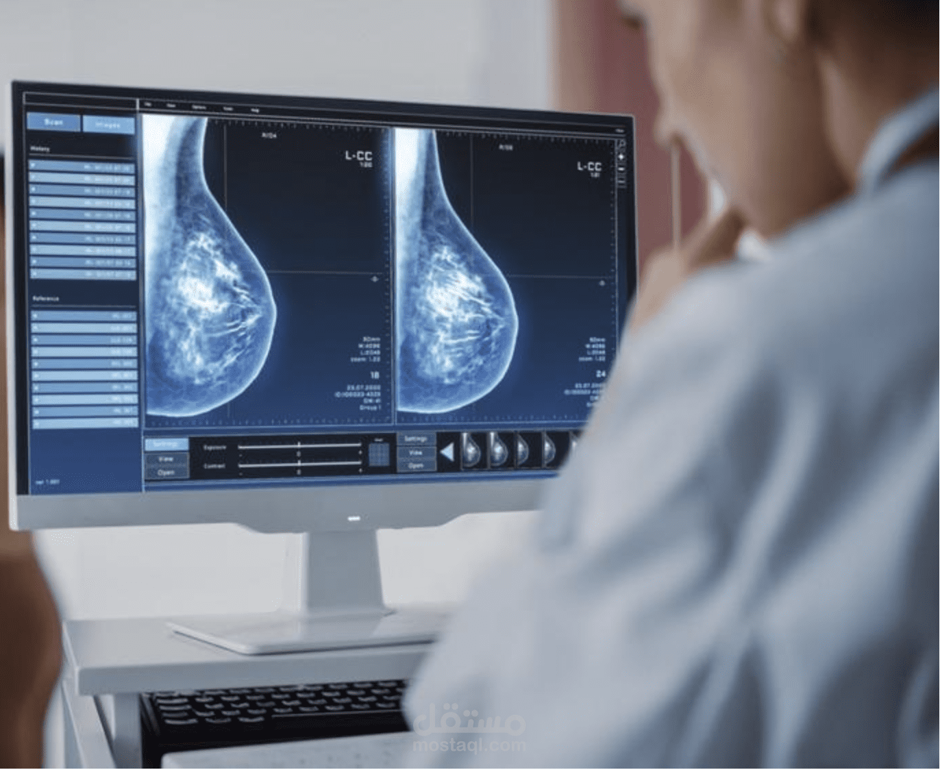 Breast Cancer Classification