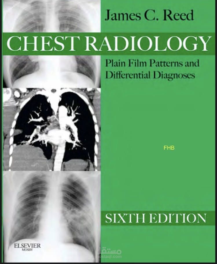 ترجمة جزء من كتاب chest radiology