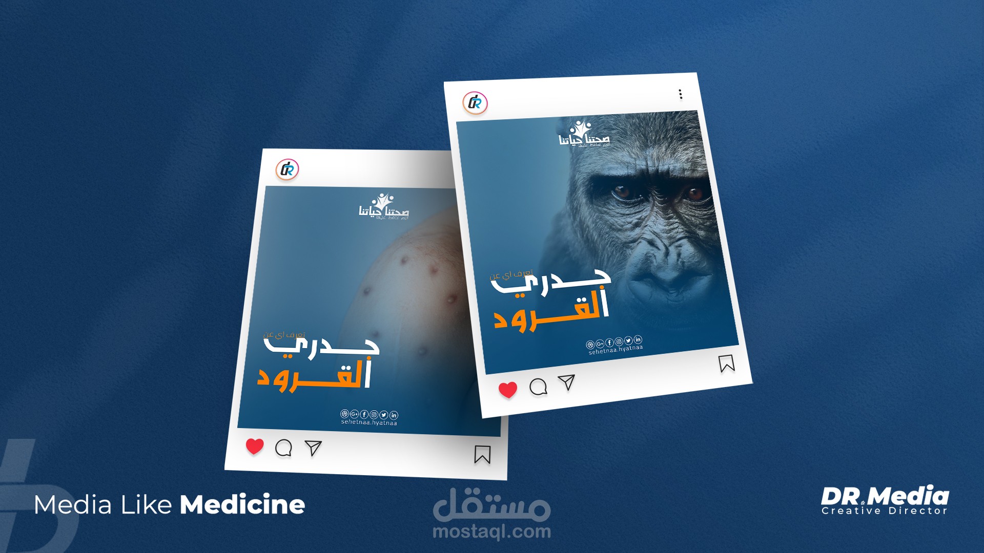 حملة دعائية عن مرض جدري القرود