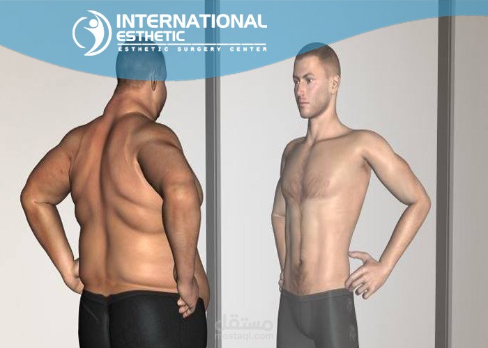 الجديد في عمليات شفط الدهون في تركيا