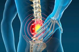 علاج آلآم اسفل الظهر