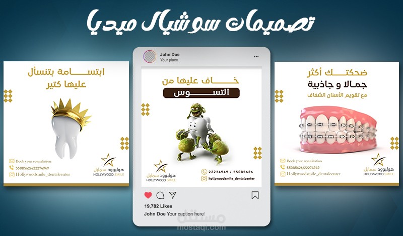 تصميم بوستات سوشيال ميديا لمركز أسنان ( هوليود سمايل )