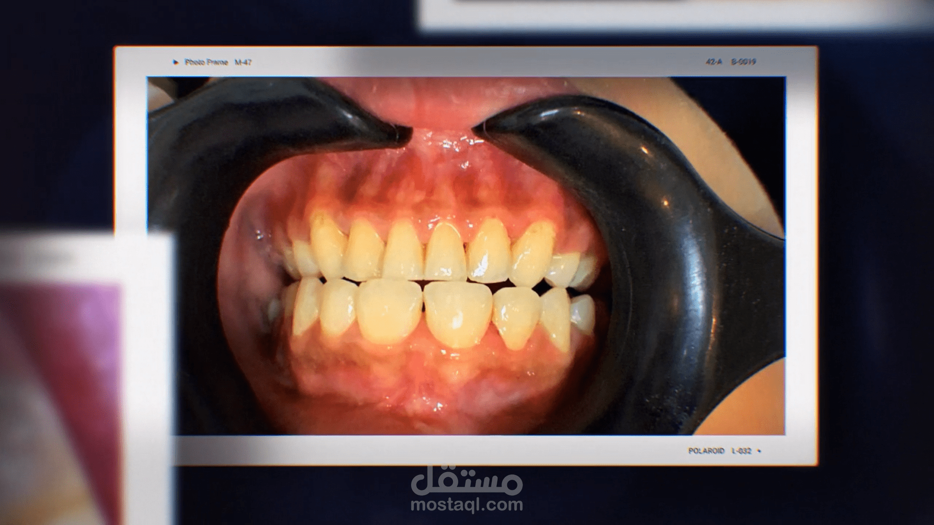 فيديوهات دعائية وترويجية لشركة أنظمة أمنية