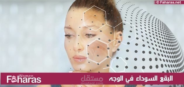 كتابة مقال عن: البقع السوداء في الوجه