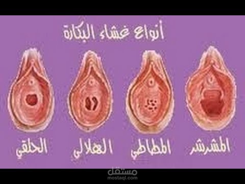 علامات تدل على وجود غشاء بكارة بالصور